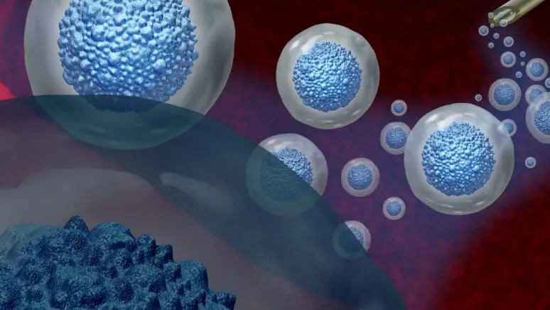 NKM免疫細胞療法のイメージ